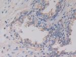 AMH Monoclonal Antibody (C6)