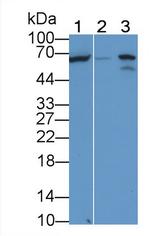 ALPL Antibody in Western Blot (WB)