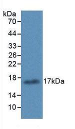 ALOX15 Monoclonal Antibody (6#)