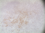 CD138 Antibody in Immunohistochemistry (Paraffin) (IHC (P))