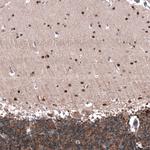 ID1 Antibody in Immunohistochemistry (Paraffin) (IHC (P))