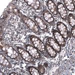 ID1 Antibody in Immunohistochemistry (Paraffin) (IHC (P))