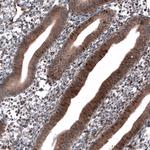 ID1 Antibody in Immunohistochemistry (Paraffin) (IHC (P))
