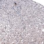 ID1 Antibody in Immunohistochemistry (Paraffin) (IHC (P))