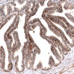 ID1 Antibody in Immunohistochemistry (Paraffin) (IHC (P))