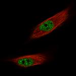 FOXM1 Monoclonal Antibody (CL12131)