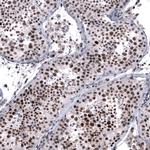 FOXM1 Antibody in Immunohistochemistry (Paraffin) (IHC (P))