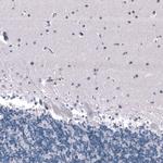 SALL4 Antibody in Immunohistochemistry (Paraffin) (IHC (P))