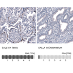 SALL4 Antibody in Immunohistochemistry (Paraffin) (IHC (P))