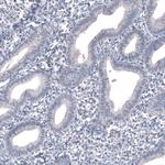 SALL4 Antibody in Immunohistochemistry (Paraffin) (IHC (P))