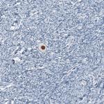 SALL4 Antibody in Immunohistochemistry (Paraffin) (IHC (P))