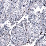 SALL4 Antibody in Immunohistochemistry (Paraffin) (IHC (P))