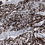 SALL4 Antibody in Immunohistochemistry (Paraffin) (IHC (P))