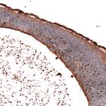 SALL4 Antibody in Immunohistochemistry (Paraffin) (IHC (P))