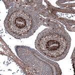SALL4 Antibody in Immunohistochemistry (Paraffin) (IHC (P))