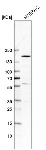 SALL4 Antibody in Western Blot (WB)
