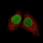 SALL4 Monoclonal Antibody (CL12183)