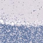 SALL4 Antibody in Immunohistochemistry (Paraffin) (IHC (P))