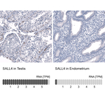 SALL4 Antibody in Immunohistochemistry (Paraffin) (IHC (P))
