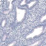 SALL4 Antibody in Immunohistochemistry (Paraffin) (IHC (P))