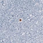 SALL4 Antibody in Immunohistochemistry (Paraffin) (IHC (P))