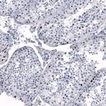 SALL4 Antibody in Immunohistochemistry (Paraffin) (IHC (P))