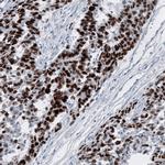 SALL4 Antibody in Immunohistochemistry (Paraffin) (IHC (P))