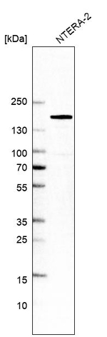 SALL4 Antibody in Western Blot (WB)