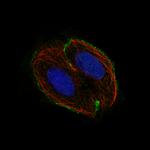 CSF1R Antibody in Immunocytochemistry (ICC/IF)