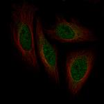 ISL1 Monoclonal Antibody (CL11651)