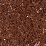 CHI3L1 Antibody in Immunohistochemistry (Paraffin) (IHC (P))