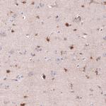 CHI3L1 Antibody in Immunohistochemistry (Paraffin) (IHC (P))