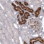 CHI3L1 Antibody in Immunohistochemistry (Paraffin) (IHC (P))