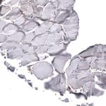 CHI3L1 Antibody in Immunohistochemistry (Paraffin) (IHC (P))