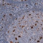 CHI3L1 Antibody in Immunohistochemistry (Paraffin) (IHC (P))