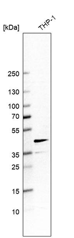 CHI3L1 Antibody in Western Blot (WB)