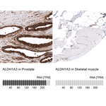 ALDH1A3 Antibody in Immunohistochemistry (Paraffin) (IHC (P))