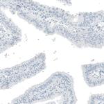 OTP Antibody in Immunohistochemistry (Paraffin) (IHC (P))