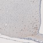 OTP Antibody in Immunohistochemistry (Paraffin) (IHC (P))