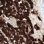 Chromogranin B Antibody in Immunohistochemistry (Paraffin) (IHC (P))