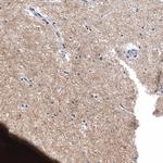 Chromogranin B Antibody in Immunohistochemistry (Paraffin) (IHC (P))