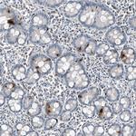 Chromogranin B Antibody in Immunohistochemistry (Paraffin) (IHC (P))