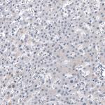 Chromogranin B Antibody in Immunohistochemistry (Paraffin) (IHC (P))