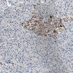 Chromogranin B Antibody in Immunohistochemistry (Paraffin) (IHC (P))