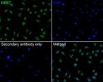 REST Antibody in Immunocytochemistry (ICC/IF)