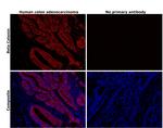 beta Catenin Recombinant Rabbit Monoclonal Antibody (BLR086G)