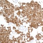 CD163 Antibody in Immunohistochemistry (Paraffin) (IHC (P))