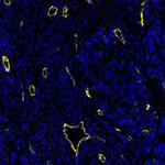 CD144 (VE-cadherin) Antibody in Immunohistochemistry (Paraffin) (IHC (P))