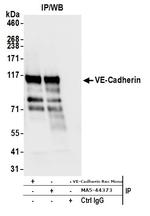 CD144 (VE-cadherin) Antibody in Immunoprecipitation (IP)