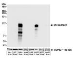 CD144 (VE-cadherin) Antibody in Western Blot (WB)